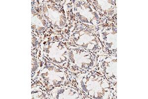 Immunohistochemical analysis of paraffin-embedded human colon tissue using C performed on the Leica® BOND RXm. (NOX1 antibody  (AA 243-271))