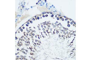 Immunohistochemistry of paraffin-embedded rat testis using CCR7 Rabbit mAb (ABIN7266309) at dilution of 1:100 (40x lens). (CCR7 antibody)