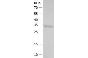 Western Blotting (WB) image for Tryptophan Hydroxylase 1 (TPH1) (AA 105-420) protein (His tag) (ABIN7285518) (Tryptophan Hydroxylase 1 Protein (TPH1) (AA 105-420) (His tag))