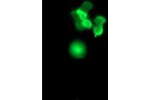Image no. 1 for anti-Sex Determining Region Y (SRY) antibody (ABIN1501139) (SRY antibody)