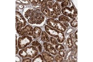 Immunohistochemical staining of human kidney with MRPL12 polyclonal antibody  shows strong cytopmasmic positivity with granular pattern in cells in tubules and cells in glomeruli. (SLC25A10 antibody)