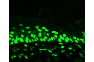 Acetylated Lysine (7F8), mouse backskin (Lysine (lys) (acetylated) antibody)