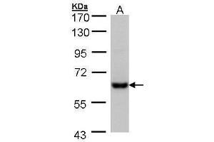 WB Image Sample (30 ug of whole cell lysate) A: Hep G2 , 7. (CES2 antibody)