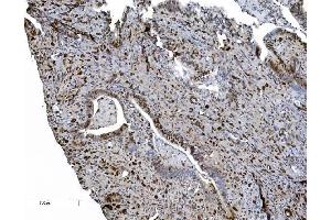 IHC analysis of MCM6 using anti-MCM6 antibody (ABIN7600036).
