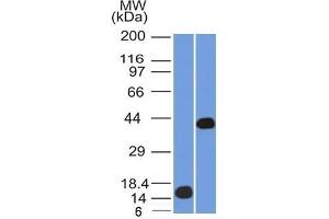 Western Blotting (WB) image for anti-alpha-Methylacyl-CoA Racemase (AMACR) (AA 297-394) antibody (ABIN6939431)