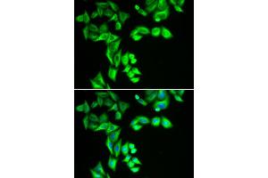 Immunofluorescence analysis of HeLa cell using STRN3 antibody. (STRN3 antibody)