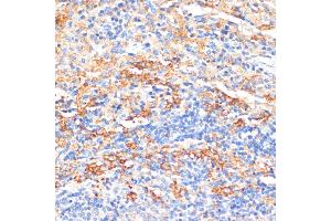 Immunohistochemistry of paraffin-embedded rat spleen using APCS antibody (ABIN3022713, ABIN3022714, ABIN3022715, ABIN1512583 and ABIN6219158) at dilution of 1:100 (40x lens). (APCS antibody  (AA 1-223))