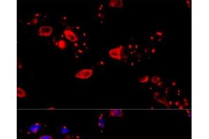 Immunofluorescence analysis of HeLa cells using CCT8 Polyclonal Antibody at dilution of 1:100 (40x lens).