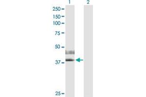 Western Blot analysis of IL2RG expression in transfected 293T cell line by IL2RG MaxPab polyclonal antibody. (IL2RG antibody  (AA 1-369))