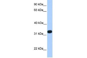WB Suggested Anti-ACRV1 Antibody Titration: 0. (ACRV1 antibody  (N-Term))