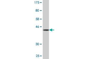 Western Blot detection against Immunogen (43. (GPSM3 antibody  (AA 1-160))