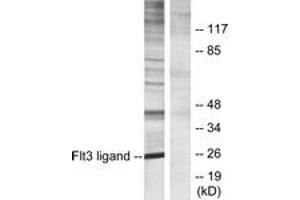 Western blot analysis of extracts from Jurkat cells, using Flt3 ligand Antibody.