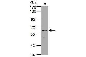 WB Image Sample(30 ug whole cell lysate) A:A431, 7. (P2RX7 antibody  (Center))