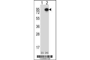 Western blot analysis of CTTN using rabbit polyclonal CTTN Antibody using 293 cell lysates (2 ug/lane) either nontransfected (Lane 1) or transiently transfected (Lane 2) with the CTTN gene. (Cortactin antibody  (AA 273-302))