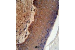 Immunohistochemistry (IHC) image for anti-Keratin 9 (KRT9) antibody (ABIN3003130) (KRT9 antibody)
