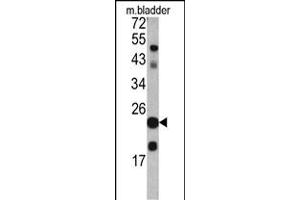Western blot analysis of TAGLN antibody (C-term) (ABIN390627 and ABIN2840932) in mouse bladder tissue lysates (35 μg/lane). (Transgelin antibody  (C-Term))