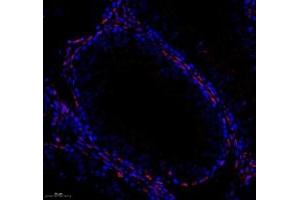 Immunofluorescent analysis of paraformaldehyde-fixed mouse testis using,PARIS (ABIN7076272) at dilution of 1: 3000 (ZNF746 antibody)