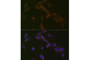 Immunofluorescence analysis of NIH-3T3 cells using RA Rabbit mAb (ABIN7269817) at dilution of 1:100 (40x lens). (RAB9A antibody)