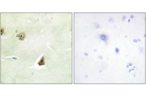 Immunohistochemistry analysis of paraffin-embedded human brain tissue, using DUSP6 Antibody. (DUSP6 antibody  (AA 61-110))