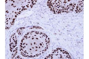IHC-P Image Immunohistochemical analysis of paraffin-embedded Cal27 Xenograft, using NuMA , antibody at 1:100 dilution. (NUMA1 antibody  (N-Term))