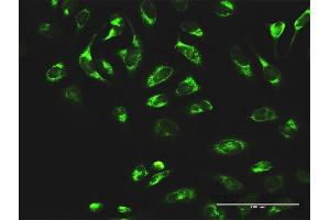 Immunofluorescence of purified MaxPab antibody to MTDH on HeLa cell. (MTDH antibody  (AA 1-582))