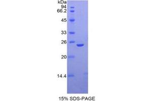 SDS-PAGE (SDS) image for Thrombospondin 1 (THBS1) (AA 61-259) protein (His tag) (ABIN2122192)