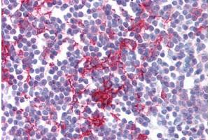 Tonsil, Human: Formalin-Fixed Paraffin-Embedded (FFPE)