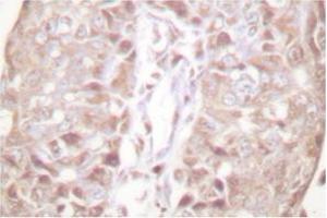 Image no. 2 for anti-SUMO1/sentrin Specific Peptidase 1 (SENP1) antibody (ABIN271955)