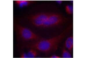 Image no. 1 for anti-Synuclein, alpha (SNCA) (AA 131-135) antibody (ABIN401571) (SNCA antibody  (AA 131-135))