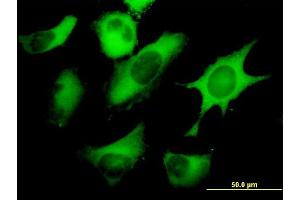 Immunofluorescence of monoclonal antibody to FASN on HeLa cell. (Fatty Acid Synthase antibody  (AA 1-439))
