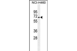 ZSCAN5B Antibody (C-term) (ABIN655366 and ABIN2844923) western blot analysis in NCI- cell line lysates (35 μg/lane). (ZSCAN5B antibody  (C-Term))