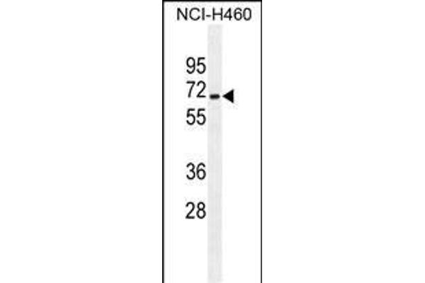ZSCAN5B antibody  (C-Term)