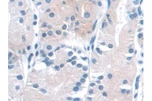 Detection of NADK in Human Stomach Tissue using Polyclonal Antibody to NAD Kinase (NADK) (NADK antibody  (AA 187-426))