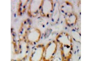 Used in DAB staining on fromalin fixed paraffin-embedded Kidney tissue (PKN1 antibody  (AA 615-874))