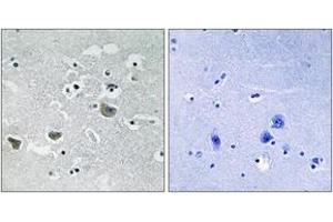 Immunohistochemistry analysis of paraffin-embedded human brain tissue, using SREBP-1 (Ab-439) Antibody. (SREBF1 antibody  (AA 405-454))