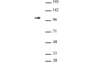 SFMBT1 antibody (pAb) tested by Western blot. (SFMBT1 antibody)