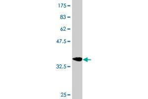 Western Blot detection against Immunogen (36. (CDO1 antibody  (AA 101-200))