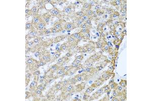 Immunohistochemistry of paraffin-embedded human liver using TMEM189 antibody (ABIN5975796) at dilution of 1/100 (40x lens).