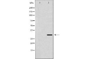 Western blot analysis of extracts of HepG2 cells, using HLA-DRB3 antibody. (HLA-DRB3 antibody)