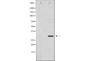 Western blot analysis of extracts of HepG2 cells, using HLA-DRB3 antibody. (HLA-DRB3 antibody)