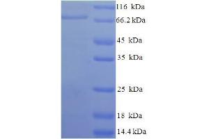 SDS-PAGE (SDS) image for Apoptosis-Inducing Factor, Mitochondrion-Associated, 1 (AIFM1) (AA 103-612), (partial) protein (His-SUMO Tag) (ABIN5709025) (AIF Protein (AA 103-612, partial) (His-SUMO Tag))
