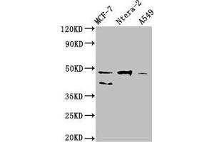 Western Blot Positive WB detected in: MCF-7 whole cell lysate, Ntera-2 whole cell lysate, A549 whole cell lysate All lanes: NANOG antibody at 1:500 Secondary Goat polyclonal to Mouse IgG at 1/10000 dilution Predicted band size: 35, 33 kDa Observed band size: 46, 40 kDa