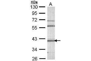 WB Image Sample (30 ug of whole cell lysate) A: Molt-4 , 10% SDS PAGE antibody diluted at 1:1000 (CAMK1D antibody)