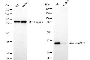 Western blotting analysis using SCAMP2 antibody (ABIN7800289).