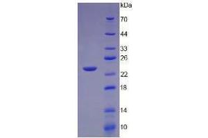 Image no. 1 for Lymphotoxin-alpha (LTA) (AA 35-205) (Active) protein (His tag) (ABIN6239734) (LTA Protein (AA 35-205) (His tag))
