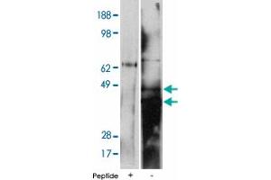 Western blot using DEGS2 polyclonal antibody on human kidney cell lysate at 15 ug/lane.