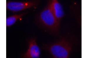 Immunofluorescence (IF) image for anti-zeta-Chain (TCR) Associated Protein Kinase 70kDa (ZAP70) (pTyr319) antibody (ABIN1682143) (ZAP70 antibody  (pTyr319))