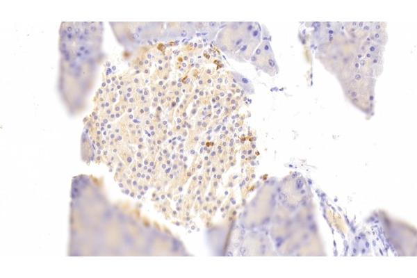 DGKZ antibody  (AA 657-879)