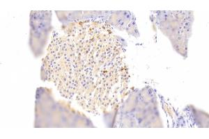 Detection of DGKz in Mouse Pancreas Tissue using Polyclonal Antibody to Diacylglycerol Kinase Zeta (DGKz) (DGKZ antibody  (AA 657-879))