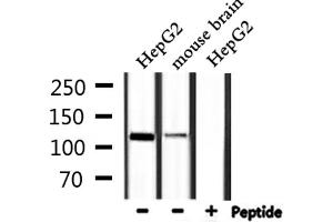 Western blot analysis of extracts from HepG2,mouse brain, using IARS2 Antibody. (IARS2 antibody  (N-Term))